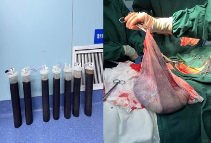 1701848364285279.jpg 圖片2.jpg