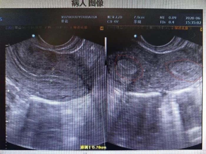 1705989391489833.jpg 640.jpg