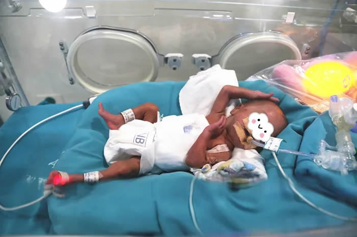 1709802488385454.jpg 640 (3).jpg