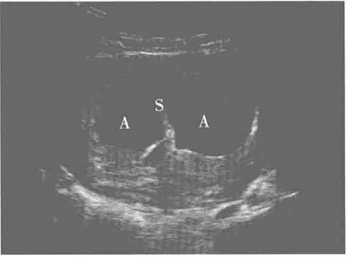 1745938459884186.jpg 微信圖片_20250429225009.jpg