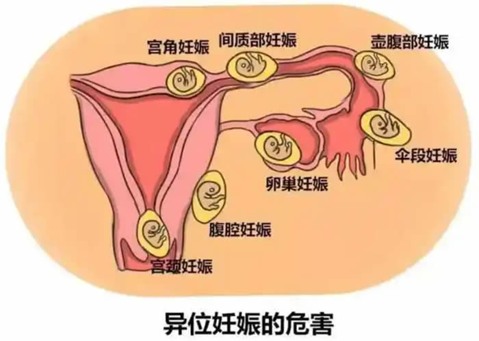 1751813677717930.jpg 微信圖片_2025-07-06_225051_105.jpg